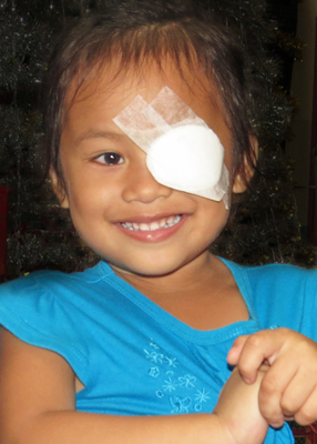 Smiling girl after cataract surgery